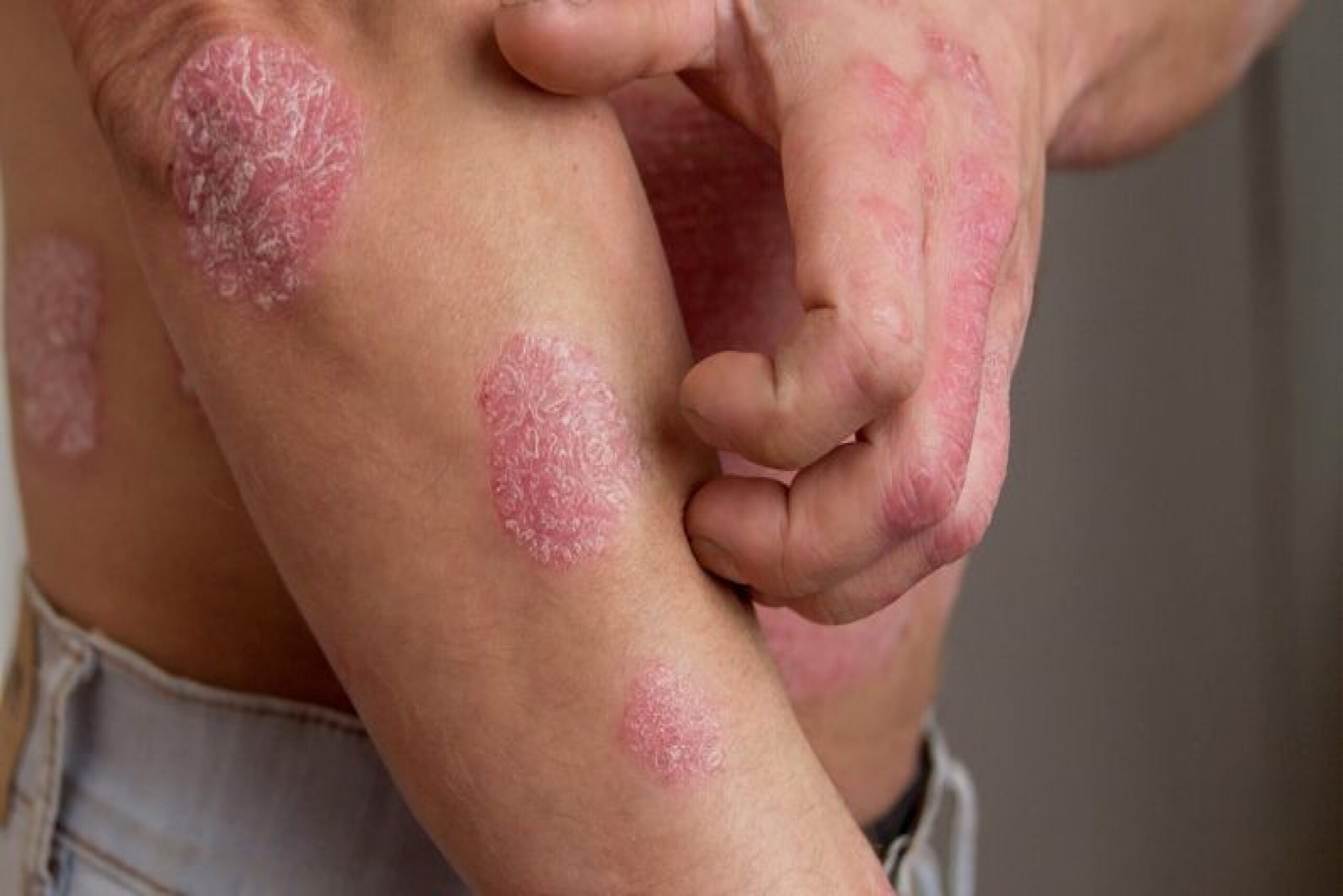 Best Dermatologist/Skin Specialist Doctor in Chittagong